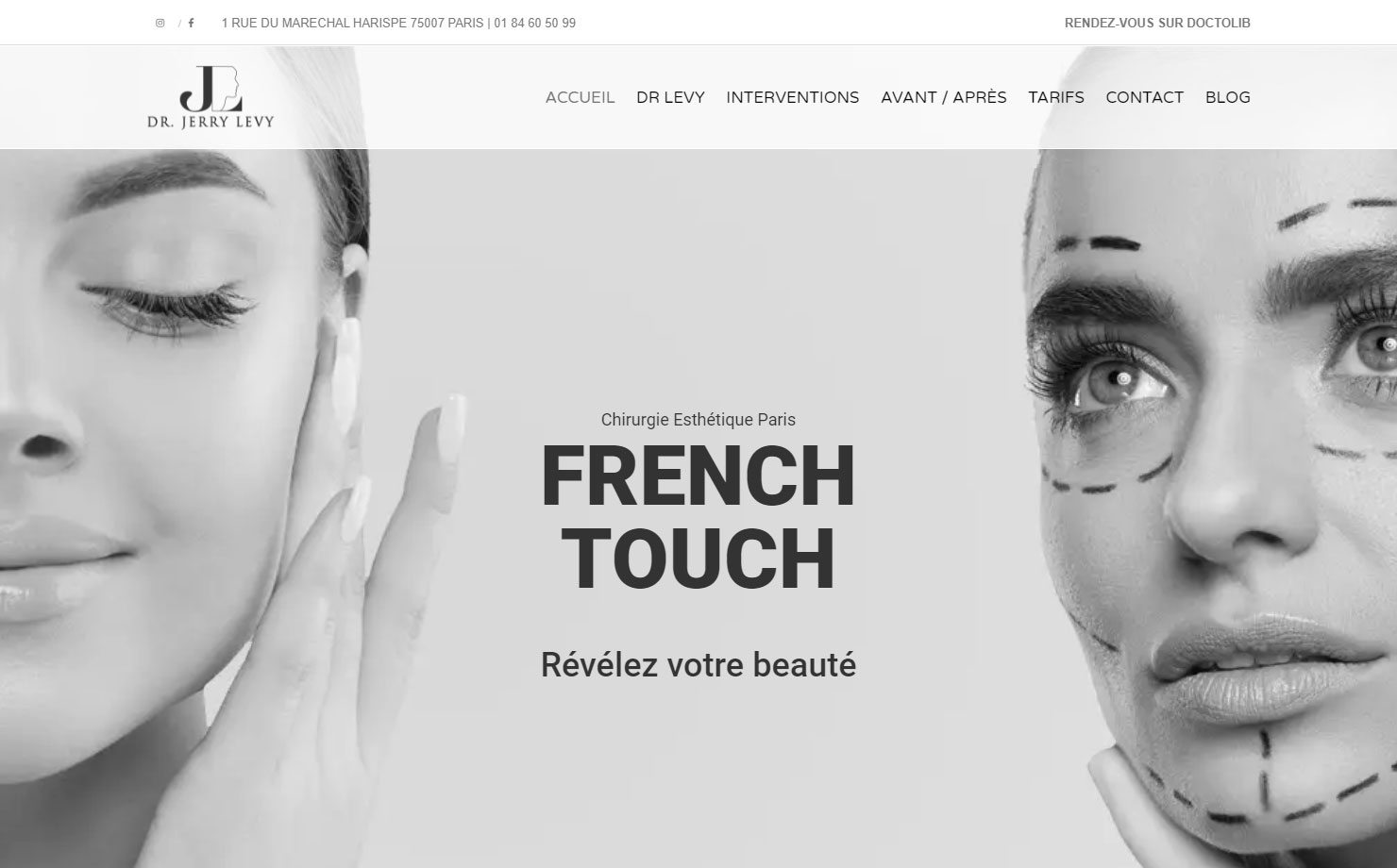 Dr Levy Chirurgien esthétique à Paris